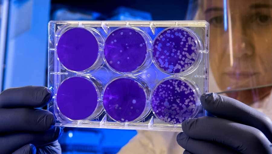 Gut microbiota can change with the carnivore diet – Copy The carnivore diet can change your gut microbiota